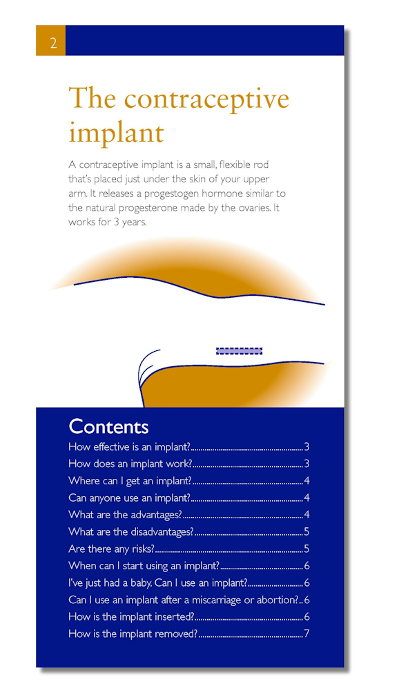 Contraceptive Implant: The FPA Guide