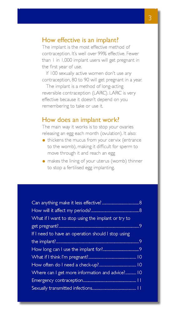 Contraceptive Implant: The FPA Guide