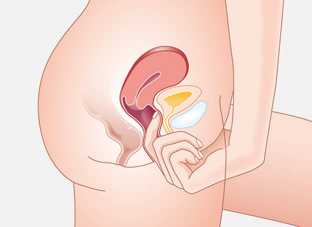 Feeling for the pubic bone