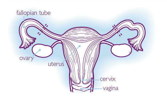Female Sterilisation Tubal Occlusion
