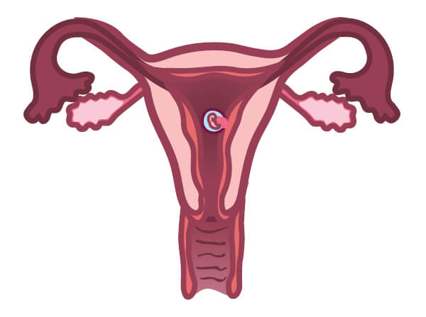 Fertilisation/implantation of the egg Fertilisation/implantation of the egg